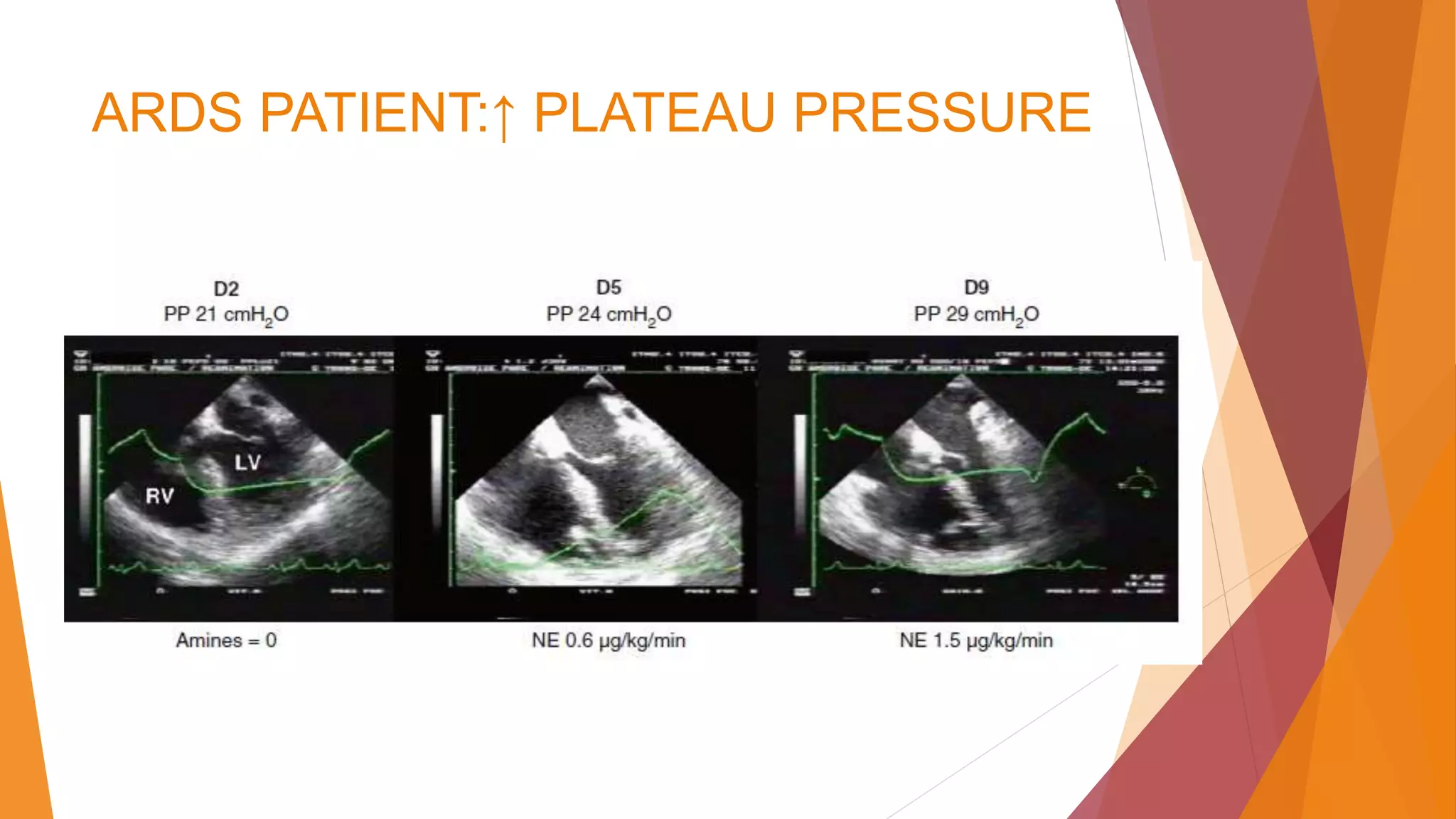 ARDS PATIENT:↑ PLATEAU PRESSURE