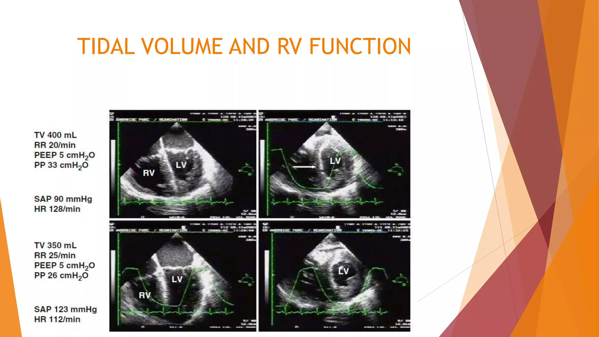 TIDAL VOLUME AND RV FUNCTION