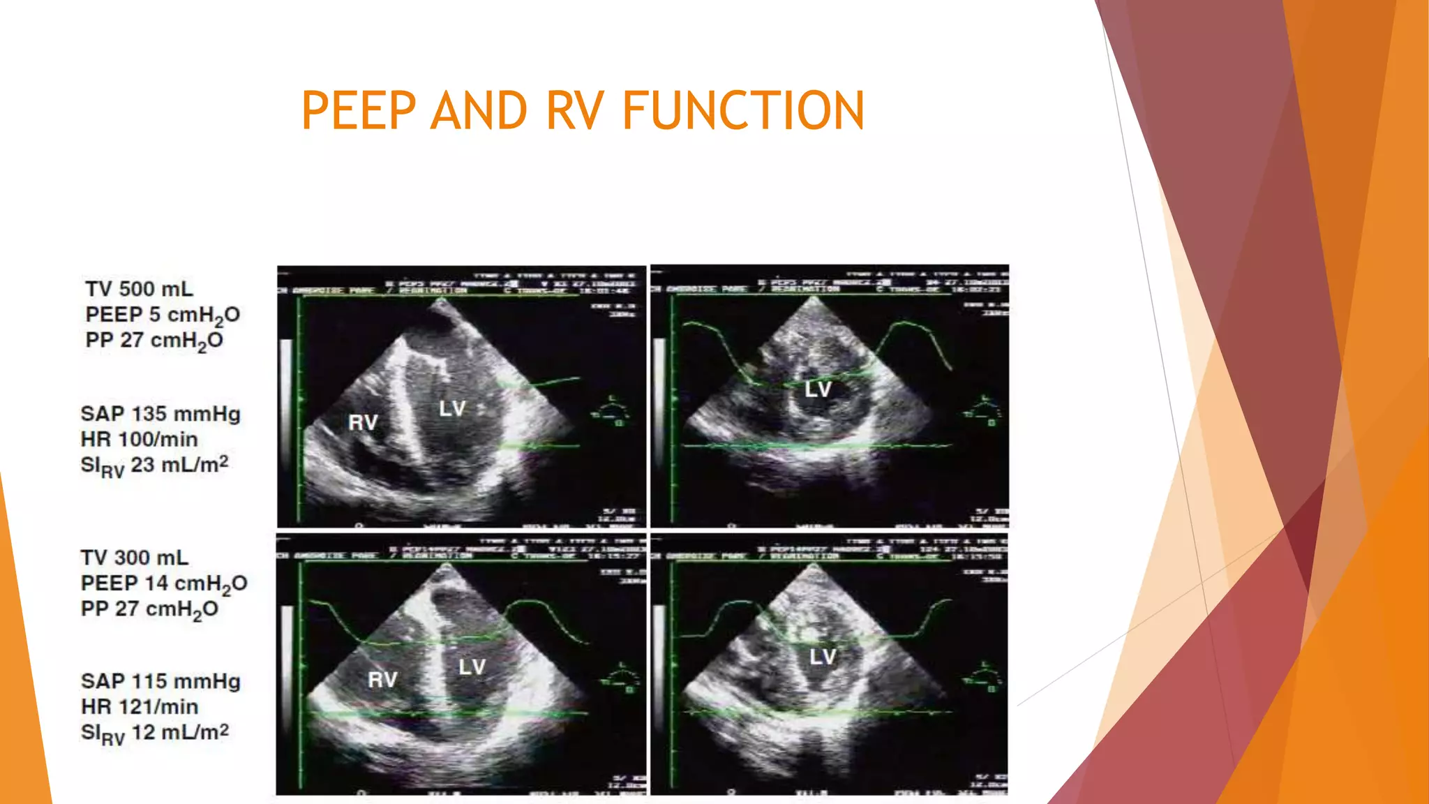 PEEP AND RV FUNCTION