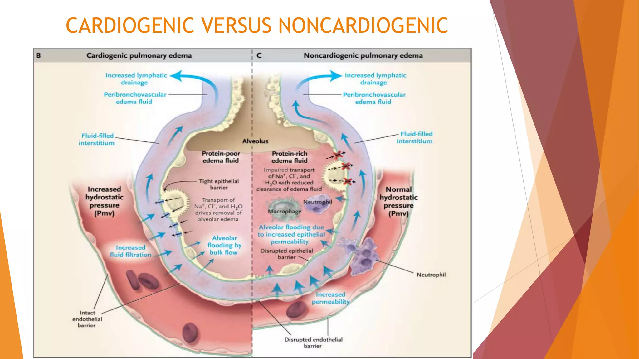 CARDIOGENIC VERSUS NONCARDIOGENIC