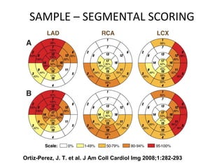 SAMPLE – SEGMENTAL SCORING
Ortiz-Perez, J. T. et al. J Am Coll Cardiol Img 2008;1:282-293
 