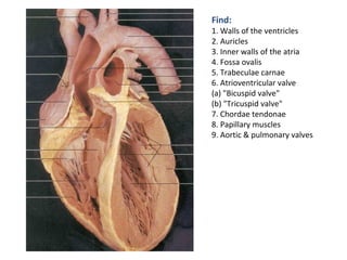 Find:
1. Walls of the ventricles
2. Auricles
3. Inner walls of the atria
4. Fossa ovalis
5. Trabeculae carnae
6. Atrioventricular valve
(a) "Bicuspid valve"
(b) "Tricuspid valve"
7. Chordae tendonae
8. Papillary muscles
9. Aortic & pulmonary valves
 