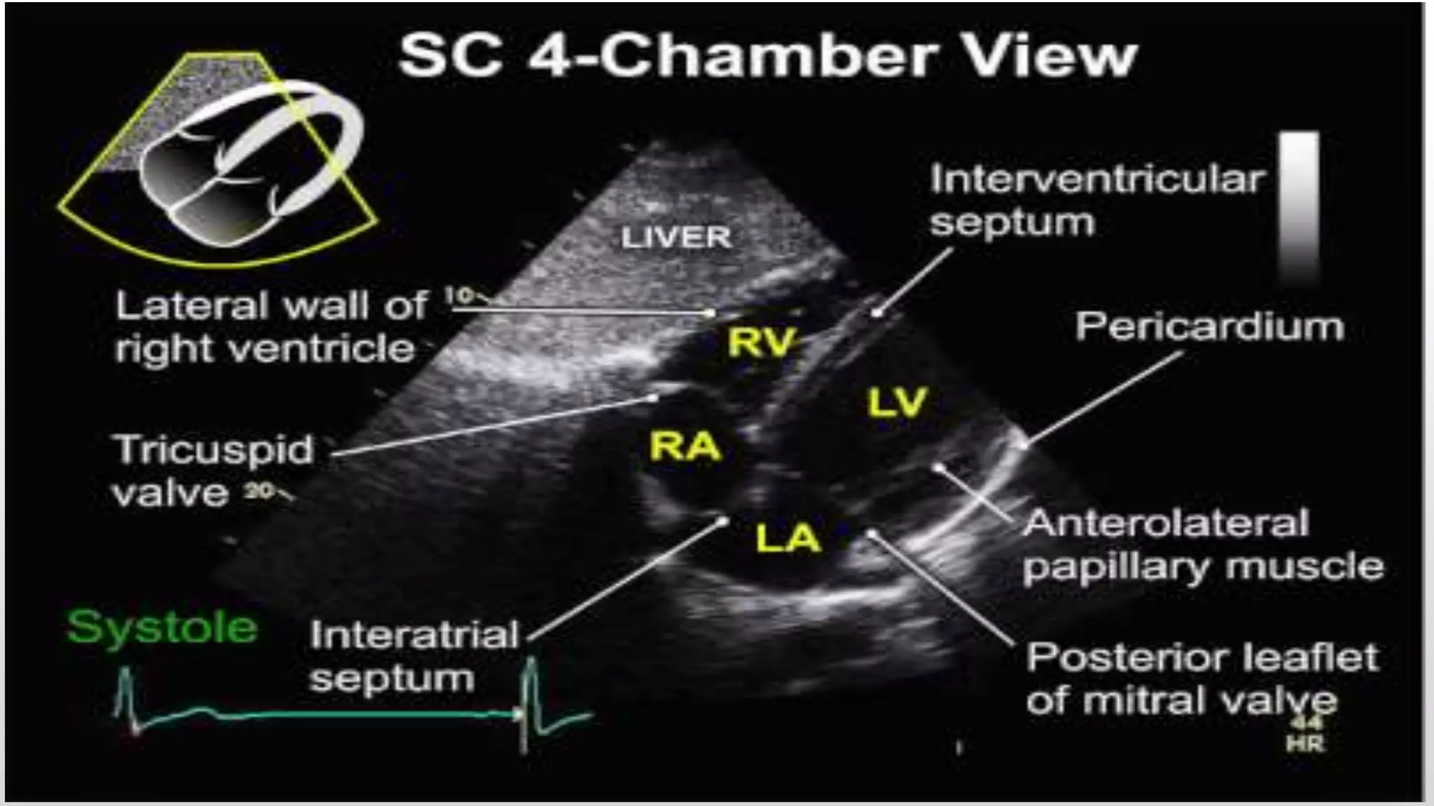 Echocardiography | PPTX