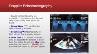 Doppler Echocardiography
▪ Doppler echocardiography is a
method for detecting the direction and
velocity of moving blood within the
heart.
▪ Pulsed Wave (PW) useful for low
velocity flow e.g. MV flow
▪ Continuous Wave (CW) useful for
high velocity flow e.g aortic stenosis
▪ Color Flow (CF) Different colors are
used to designate the direction of blood
flow. Red is flow toward, and blue is flow
away from the transducer (BART) with
turbulent flow shown as a mosaic pattern.
 