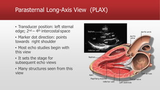 Parasternal Long-Axis View (PLAX)
▪ Transducer position: left sternal
edge; 2nd – 4th intercostal space
▪ Marker dot direction: points
towards right shoulder
▪ Most echo studies begin with
this view
▪ It sets the stage for
subsequent echo views
▪ Many structures seen from this
view
 
