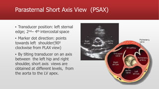 Parasternal Short Axis View (PSAX)
▪ Transducer position: left sternal
edge; 2nd– 4th intercostal space
▪ Marker dot direction: points
towards left shoulder(900
clockwise from PLAX view)
▪ By tilting transducer on an axis
between the left hip and right
shoulder, short axis views are
obtained at different levels, from
the aorta to the LV apex.
 