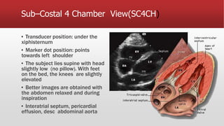Sub–Costal 4 Chamber View(SC4CH)
▪ Transducer position: under the
xiphisternum
▪ Marker dot position: points
towards left shoulder
▪ The subject lies supine with head
slightly low (no pillow). With feet
on the bed, the knees are slightly
elevated
▪ Better images are obtained with
the abdomen relaxed and during
inspiration
▪ Interatrial septum, pericardial
effusion, desc abdominal aorta
 