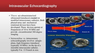 Intravascular Echocardiography
▪ There are ultraminiaturized
ultrasound transducersmounted on
modified intracoronary catheters. Both
phased-array and mechanical
rotational devices have been
developed. These devices operate at
frequencies of 10 to 30 MHz and
provide circumferential 360-degree
imaging.
▪ Intracardiac vs. intracoronary
echocardiography involves asingle-
plane, high-frequency transducer
(typically 10 MHz) on the tip of a
steerable intravascular catheter,
typically 9 to 13 French in size.
 