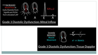 Comprehensive Echocardiographic Evaluation of Left Ventricular ...