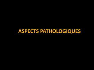 ASPECTS PATHOLOGIQUES
 
