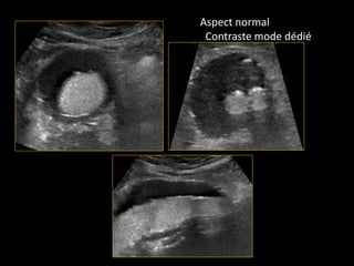 Aspect normal
Contraste mode dédié
 