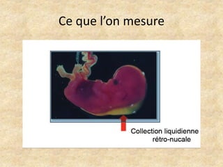 Ce que l’on mesure

 