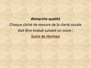démarche qualité
Chaque cliché de mesure de la clarté nucale
doit être évalué suivant un score :
Score de Herman

 