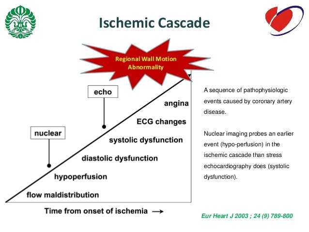 Echocardiography for A...