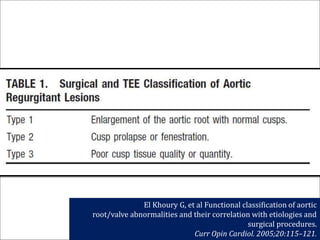 El Khoury G, et al Functional classification of aortic
root/valve abnormalities and their correlation with etiologies and
surgical procedures.
Curr Opin Cardiol. 2005;20:115–121.
 
