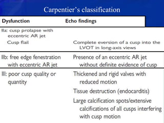 Carpentier’s classification
 