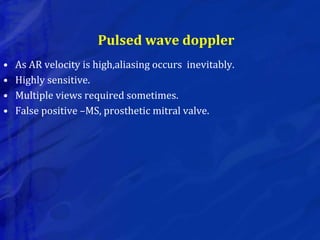 Pulsed wave doppler
• As AR velocity is high,aliasing occurs inevitably.
• Highly sensitive.
• Multiple views required sometimes.
• False positive –MS, prosthetic mitral valve.
 