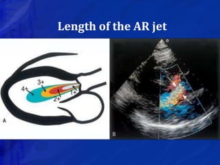 Length of the AR jet
 