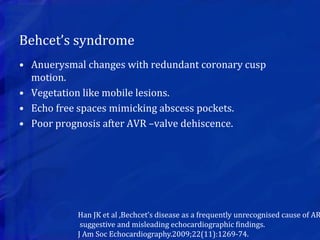 Behcet’s syndrome
• Anuerysmal changes with redundant coronary cusp
motion.
• Vegetation like mobile lesions.
• Echo free spaces mimicking abscess pockets.
• Poor prognosis after AVR –valve dehiscence.
Han JK et al ,Bechcet’s disease as a frequently unrecognised cause of AR
suggestive and misleading echocardiographic findings.
J Am Soc Echocardiography.2009;22(11):1269-74.
 