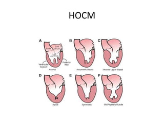 HOCM
 