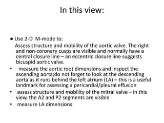 Echo indications | PPTX