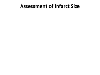 Assessment of Infarct Size
 
