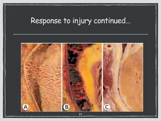 Response to injury continued…
11
 