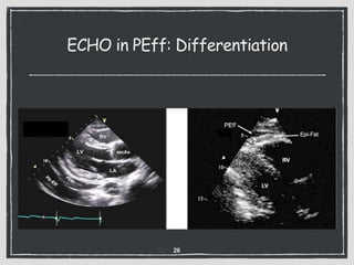 ECHO in PEff: Differentiation
26
 