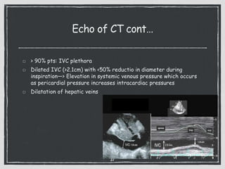 Echo of CT cont…
> 90% pts: IVC plethora
Dilated IVC (>2.1cm) with <50% reductio in diameter during
inspiration—> Elevation in systemic venous pressure which occurs
as pericardial pressure increases intracardiac pressures
Dilatation of hepatic veins
37
 