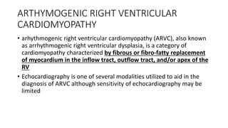 Echo in restrictive cardiomyopathy | PDF