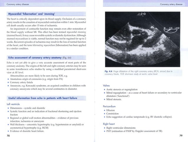Printable Echo Cardio Notes.pdf echo made easy.pdf