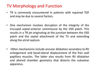 TV Morphology and Function
• TR is commonly encountered in patients with repaired TOF
and may be due to several factors.
• One mechanism involves disruption of the integrity of the
tricuspid septal-anterior commissure by the VSD patch. This
results in a TR jet originating at the junction between the VSD
patch and the septal attachment of the TV and extending
along the atrial septum.
• Other mechanisms include annular dilatation secondary to RV
enlargement and basal-lateral displacement of the free wall
papillary muscles. The latter also results from RV dilatation
and altered chamber geometry that distorts the subvalvar
apparatus.
 