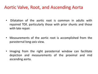 Aortic Valve, Root, and Ascending Aorta
• Dilatation of the aortic root is common in adults with
repaired TOF, particularly those with prior shunts and those
with late repair.
• Measurements of the aortic root is accomplished from the
parasternal long-axis view.
• Imaging from the right parasternal window can facilitate
depiction and measurements of the proximal and mid
ascending aorta.
 