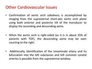 Other Cardiovascular Issues
• Confirmation of aortic arch sidedness is accomplished by
imaging from the suprasternal short-axis aortic arch plane
using both anterior and posterior tilt of the transducer to
display the ascending and descending aorta.
• When the aortic arch is right-sided (as it is in about 25% of
patients with TOF), the descending aorta may be seen
coursing to the right.
• Additionally, identification of the innominate artery and its
bifurcation into the left subclavian and left common carotid
arteries is possible from the suprasternal window.
 