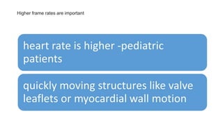 Higher frame rates are important
 