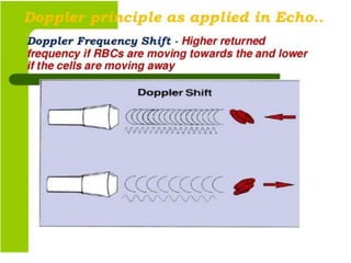Echo Physics and Doppler 