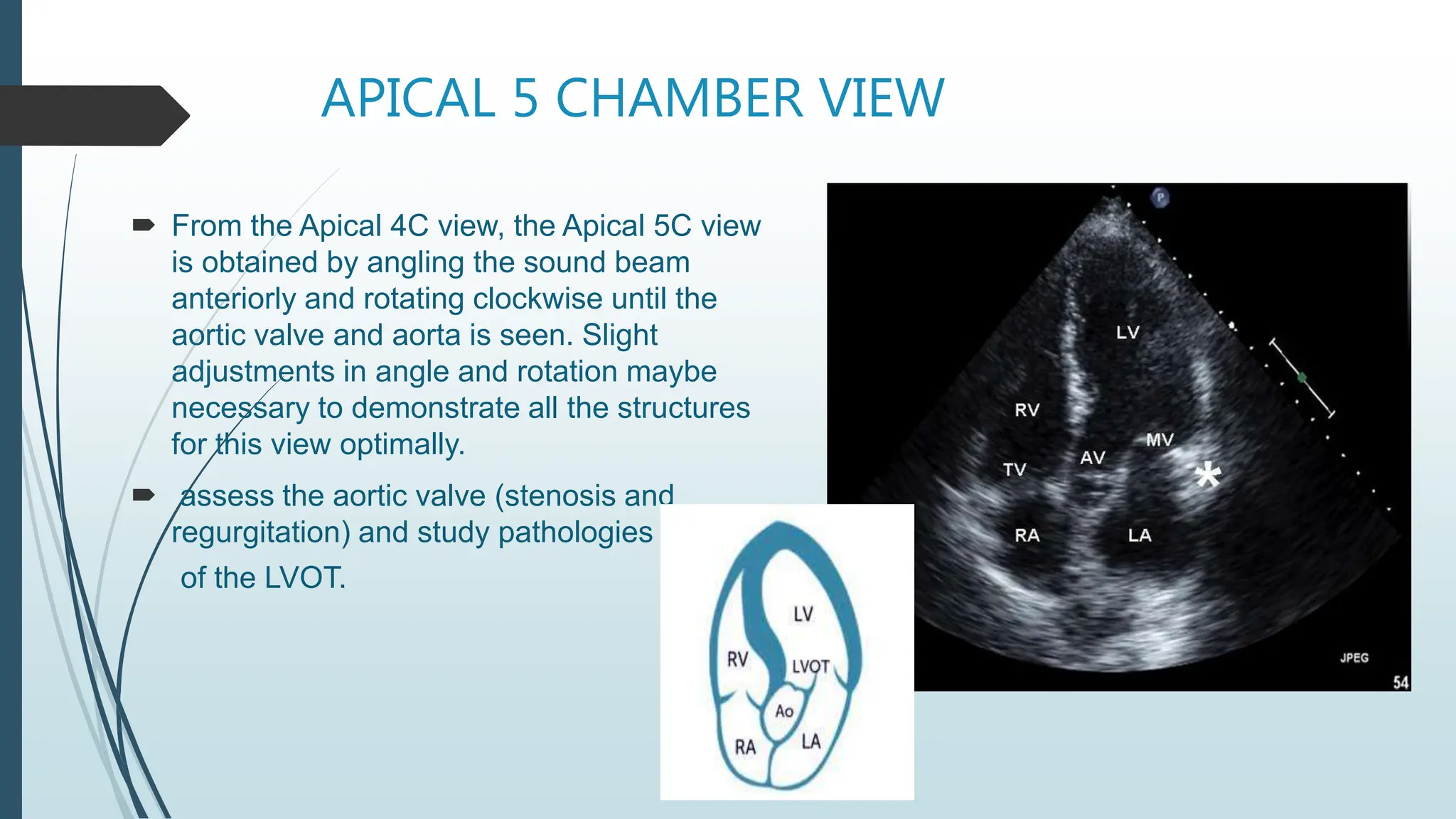 APICAL 5 CHAMBER VIEW
 From the Apical 4C view, the Apical 5C view
is obtained by angling the sound beam
anteriorly and rotating clockwise until the
aortic valve and aorta is seen. Slight
adjustments in angle and rotation maybe
necessary to demonstrate all the structures
for this view optimally.
 assess the aortic valve (stenosis and
regurgitation) and study pathologies
of the LVOT.
 