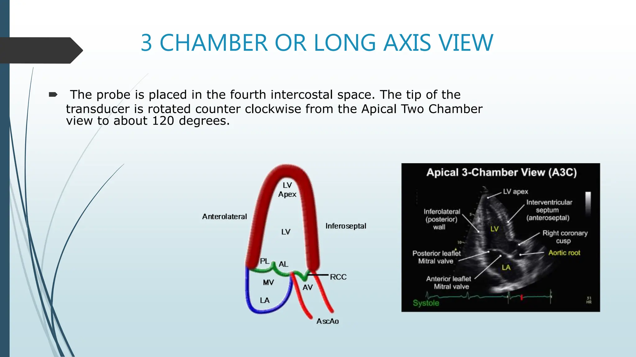 3 CHAMBER OR LONG AXIS VIEW
 The probe is placed in the fourth intercostal space. The tip of the
transducer is rotated counter clockwise from the Apical Two Chamber
view to about 120 degrees.
 