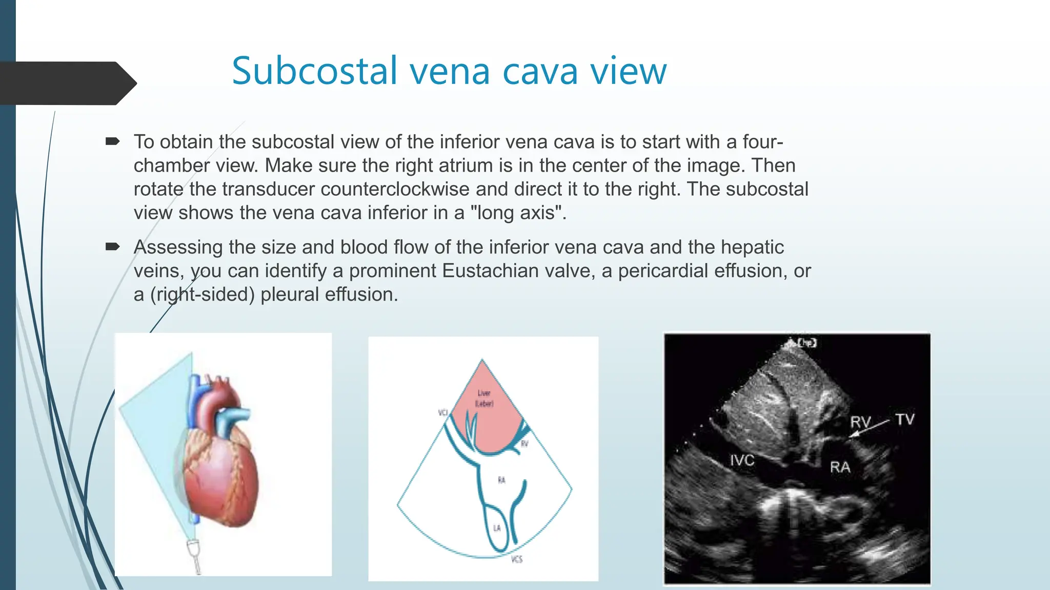 Subcostal vena cava view
 To obtain the subcostal view of the inferior vena cava is to start with a four-
chamber view. Make sure the right atrium is in the center of the image. Then
rotate the transducer counterclockwise and direct it to the right. The subcostal
view shows the vena cava inferior in a "long axis".
 Assessing the size and blood flow of the inferior vena cava and the hepatic
veins, you can identify a prominent Eustachian valve, a pericardial effusion, or
a (right-sided) pleural effusion.
 