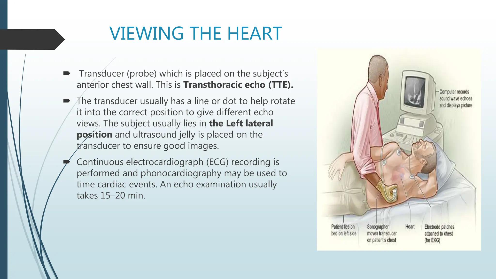 VIEWING THE HEART
 Transducer (probe) which is placed on the subject’s
anterior chest wall. This is Transthoracic echo (TTE).
 The transducer usually has a line or dot to help rotate
it into the correct position to give different echo
views. The subject usually lies in the Left lateral
position and ultrasound jelly is placed on the
transducer to ensure good images.
 Continuous electrocardiograph (ECG) recording is
performed and phonocardiography may be used to
time cardiac events. An echo examination usually
takes 15–20 min.
 