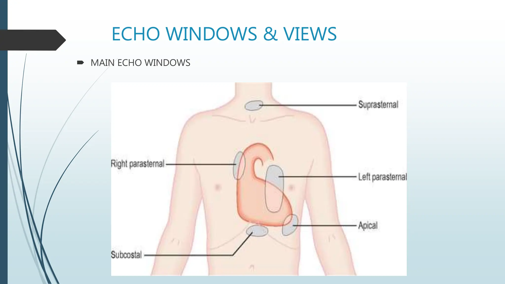 ECHO WINDOWS & VIEWS
 MAIN ECHO WINDOWS
 