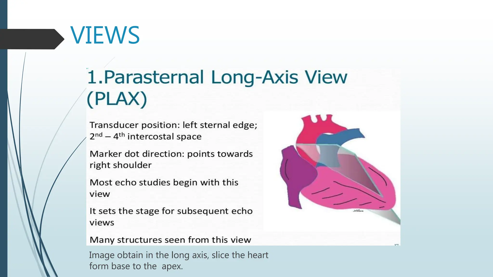 VIEWS
Image obtain in the long axis, slice the heart
form base to the apex.
 