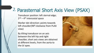 echocardiograhy window and views at large | PDF