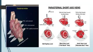 echocardiograhy window and views at large | PDF