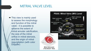 echocardiograhy window and views at large | PDF