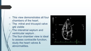 echocardiograhy window and views at large | PDF