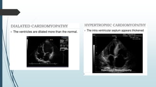 echocardiograhy window and views at large | PDF