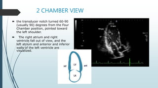 echocardiograhy window and views at large | PDF