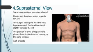 echocardiograhy window and views at large | PDF