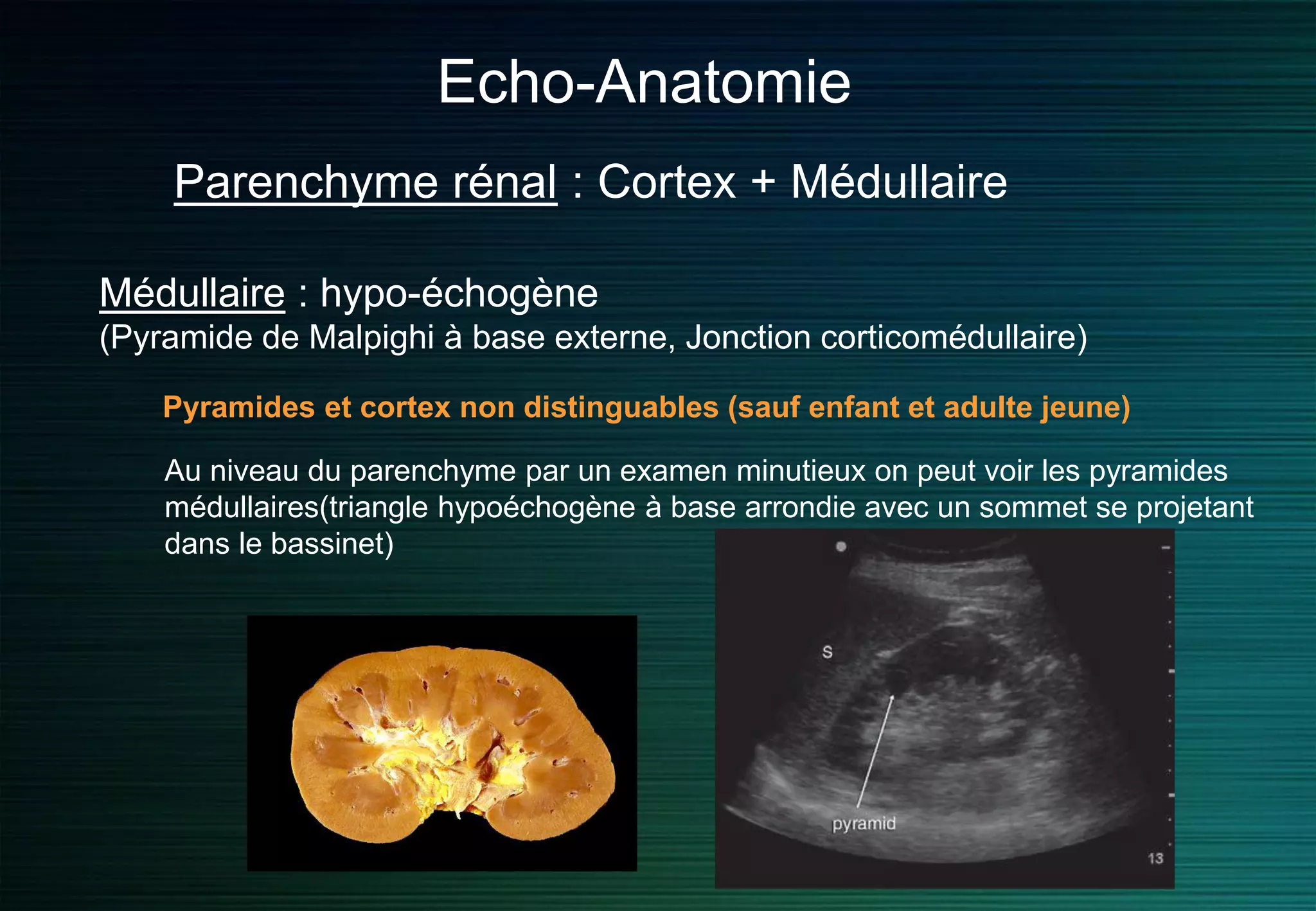 Echo-Anatomie
Parenchyme rénal : Cortex + Médullaire
Médullaire : hypo-échogène
(Pyramide de Malpighi à base externe, Jonction corticomédullaire)
Pyramides et cortex non distinguables (sauf enfant et adulte jeune)
Au niveau du parenchyme par un examen minutieux on peut voir les pyramides
médullaires(triangle hypoéchogène à base arrondie avec un sommet se projetant
dans le bassinet)
 